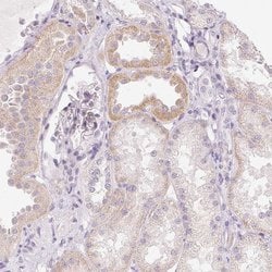 Invitrogen GSDMC Polyclonal Antibody 100 &mu;L; Unconjugated:Antibodies,