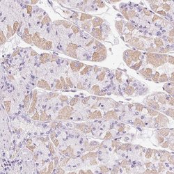 Invitrogen GSDMC Polyclonal Antibody 100 &mu;L; Unconjugated:Antibodies,