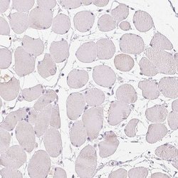 Invitrogen GSDMC Polyclonal Antibody 100 &mu;L; Unconjugated:Antibodies,