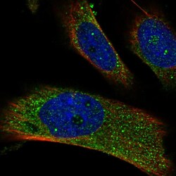 Invitrogen RAB14 Polyclonal Antibody 100 &mu;L; Unconjugated:Antibodies,