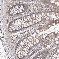 Invitrogen RAB14 Polyclonal Antibody 100 &mu;L; Unconjugated:Antibodies,