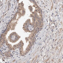 Invitrogen RAB14 Polyclonal Antibody 100 &mu;L; Unconjugated:Antibodies,