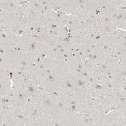 Invitrogen MRTO4 Polyclonal Antibody 100 &mu;L; Unconjugated:Antibodies,