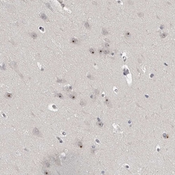 Invitrogen MRTO4 Polyclonal Antibody 100 &mu;L; Unconjugated:Antibodies,