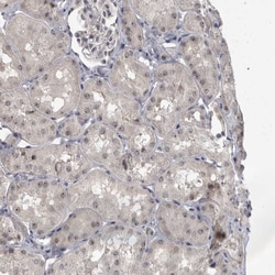 Invitrogen MRTO4 Polyclonal Antibody 100 &mu;L; Unconjugated:Antibodies,