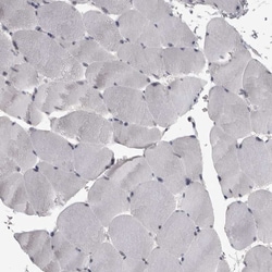 Invitrogen MRTO4 Polyclonal Antibody 100 &mu;L; Unconjugated:Antibodies,