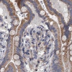 Invitrogen DBT Polyclonal Antibody 100 &mu;L; Unconjugated:Antibodies,