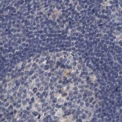 Invitrogen DBT Polyclonal Antibody 100 &mu;L; Unconjugated:Antibodies,