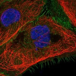Invitrogen C1QBP Polyclonal Antibody 100 &mu;L; Unconjugated:Antibodies,