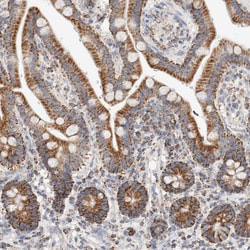 Invitrogen C1QBP Polyclonal Antibody 100 &mu;L; Unconjugated:Antibodies,
