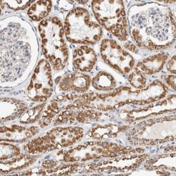 Invitrogen C1QBP Polyclonal Antibody 100 &mu;L; Unconjugated:Antibodies,