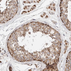 Invitrogen C1QBP Polyclonal Antibody 100 &mu;L; Unconjugated:Antibodies,