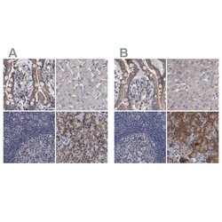 Invitrogen DBT Polyclonal Antibody 100 &mu;L; Unconjugated:Antibodies,