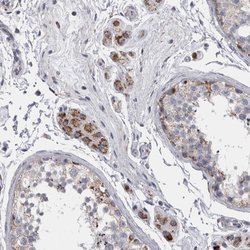 Invitrogen DBT Polyclonal Antibody 100 &mu;L; Unconjugated:Antibodies,