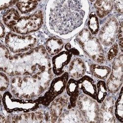 Invitrogen DBT Polyclonal Antibody 100 &mu;L; Unconjugated:Antibodies,