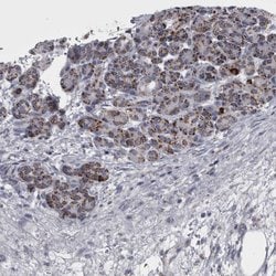 Invitrogen DBT Polyclonal Antibody 100 &mu;L; Unconjugated:Antibodies,