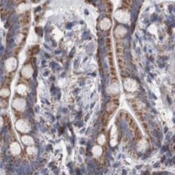 Invitrogen DBT Polyclonal Antibody 100 &mu;L; Unconjugated:Antibodies,