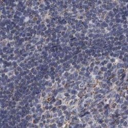 Invitrogen DBT Polyclonal Antibody 100 &mu;L; Unconjugated:Antibodies,