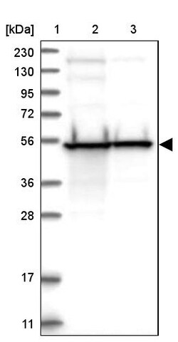 Invitrogen DBT Polyclonal Antibody 100 &mu;L; Unconjugated:Antibodies,