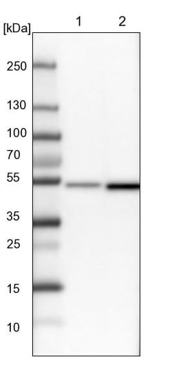 Invitrogen DBT Polyclonal Antibody 100 &mu;L; Unconjugated:Antibodies,