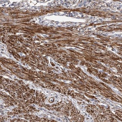 Invitrogen EPRS Polyclonal Antibody 100 &mu;L; Unconjugated:Antibodies,