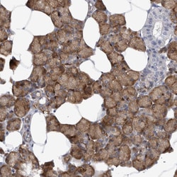 Invitrogen EPRS Polyclonal Antibody 100 &mu;L; Unconjugated:Antibodies,