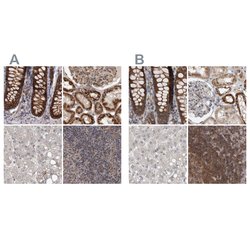 Invitrogen AspRS Polyclonal Antibody 100 &mu;L; Unconjugated:Antibodies,