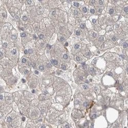 Invitrogen AspRS Polyclonal Antibody 100 &mu;L; Unconjugated:Antibodies,