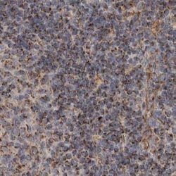 Invitrogen AspRS Polyclonal Antibody 100 &mu;L; Unconjugated:Antibodies,