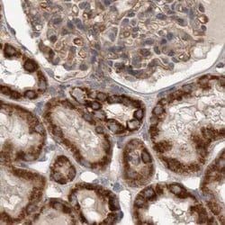 Invitrogen AspRS Polyclonal Antibody 100 &mu;L; Unconjugated:Antibodies,
