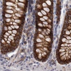 Invitrogen AspRS Polyclonal Antibody 100 &mu;L; Unconjugated:Antibodies,