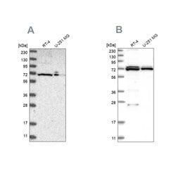 Invitrogen AspRS Polyclonal Antibody 100 &mu;L; Unconjugated:Antibodies,