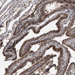 Invitrogen FSBP Polyclonal Antibody 100 &mu;L; Unconjugated:Antibodies,