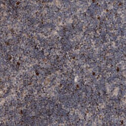 Invitrogen FSBP Polyclonal Antibody 100 &mu;L; Unconjugated:Antibodies,