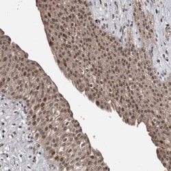 Invitrogen FSBP Polyclonal Antibody 100 &mu;L; Unconjugated:Antibodies,
