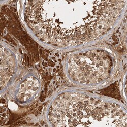 Invitrogen CAMSAP2 Polyclonal Antibody 100 &mu;L; Unconjugated:Antibodies,