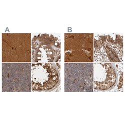 Invitrogen CAMSAP2 Polyclonal Antibody 100 &mu;L; Unconjugated:Antibodies,