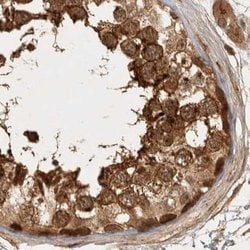 Invitrogen CAMSAP2 Polyclonal Antibody 100 &mu;L; Unconjugated:Antibodies,
