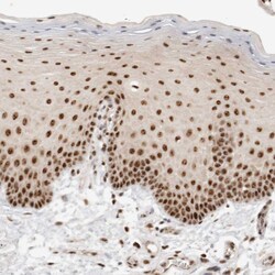Invitrogen EBNA1BP2 Polyclonal Antibody 100 &mu;L; Unconjugated:Antibodies,