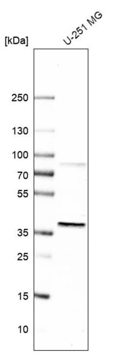 Invitrogen EBNA1BP2 Polyclonal Antibody 100 &mu;L; Unconjugated:Antibodies,
