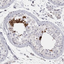 Invitrogen FNDC8 Polyclonal Antibody 100 &mu;L; Unconjugated:Antibodies,
