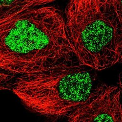 Invitrogen SNRNP40 Polyclonal Antibody 100 &mu;L; Unconjugated:Antibodies,