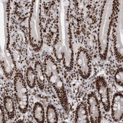 Invitrogen SNRNP40 Polyclonal Antibody 100 &mu;L; Unconjugated:Antibodies,