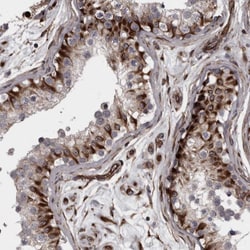 Invitrogen C17orf70 Polyclonal Antibody 100 &mu;L; Unconjugated:Antibodies,