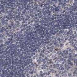 Invitrogen DBT Polyclonal Antibody 100 &mu;L | Buy Online | Invitrogen&trade; | Fisher Scientific