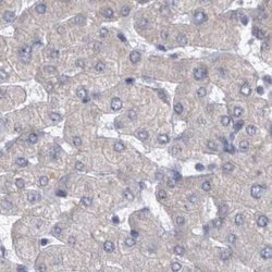 Invitrogen DBT Polyclonal Antibody 100 &mu;L | Buy Online | Invitrogen&trade; | Fisher Scientific