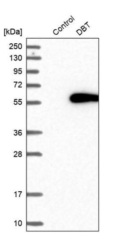Invitrogen DBT Polyclonal Antibody 100 &mu;L | Buy Online | Invitrogen&trade; | Fisher Scientific