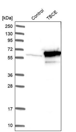 Invitrogen TBCE Polyclonal Antibody 100 &mu;L; Unconjugated:Antibodies,