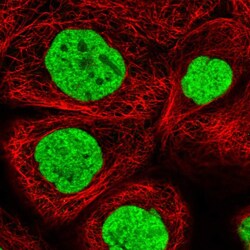 Invitrogen ALPK3 Polyclonal Antibody 100 &mu;L; Unconjugated:Antibodies,