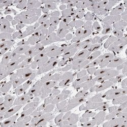 Invitrogen ALPK3 Polyclonal Antibody 100 &mu;L; Unconjugated:Antibodies,